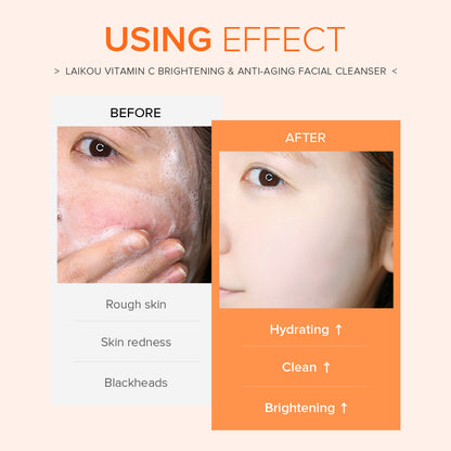 Laikou Vitamin C Skincare Cleanser