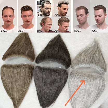 Hairline Wig Stickers Men's Bang Sticker Scalp Invisible Hair Supplementing Piece