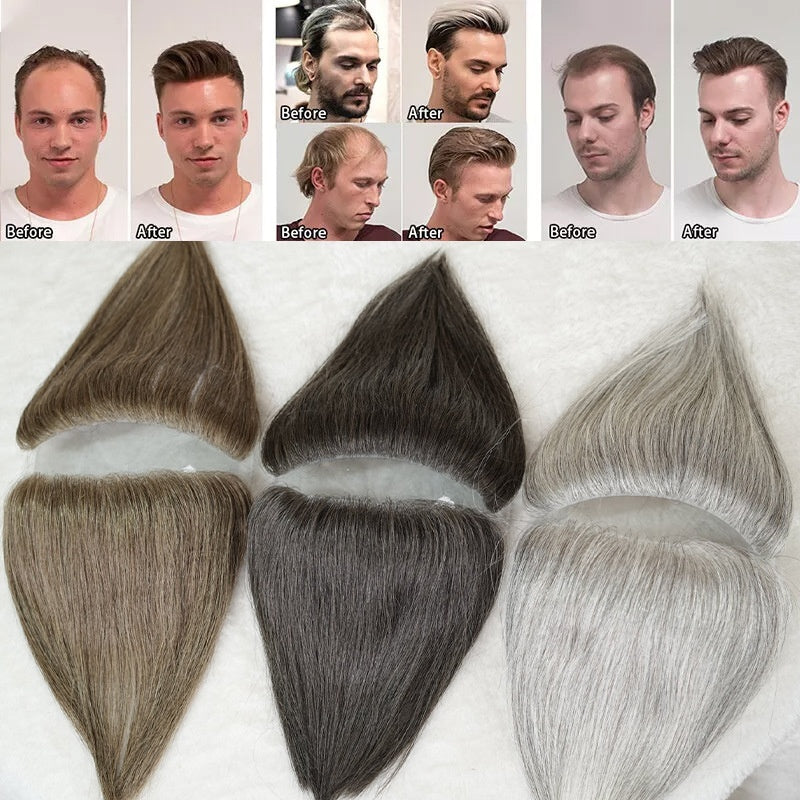 Hairline Wig Stickers Men's Bang Sticker Scalp Invisible Hair Supplementing Piece