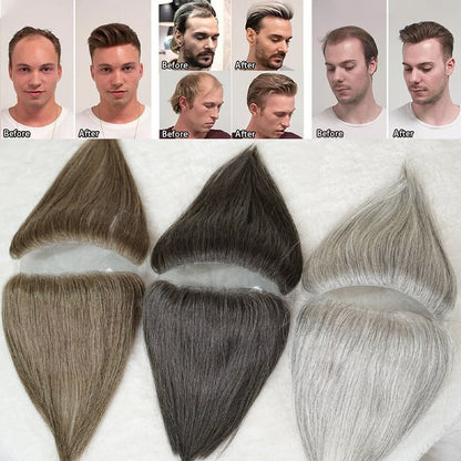 Hairline Wig Stickers Men's Bang Sticker Scalp Invisible Hair Supplementing Piece